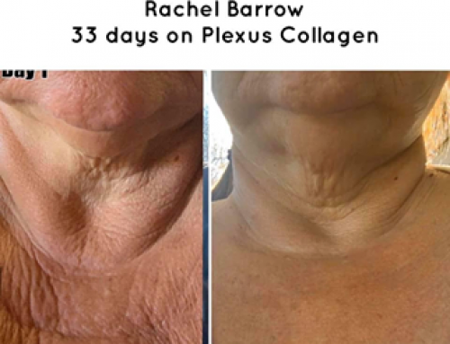 What Is Collagen?